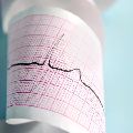 EKG